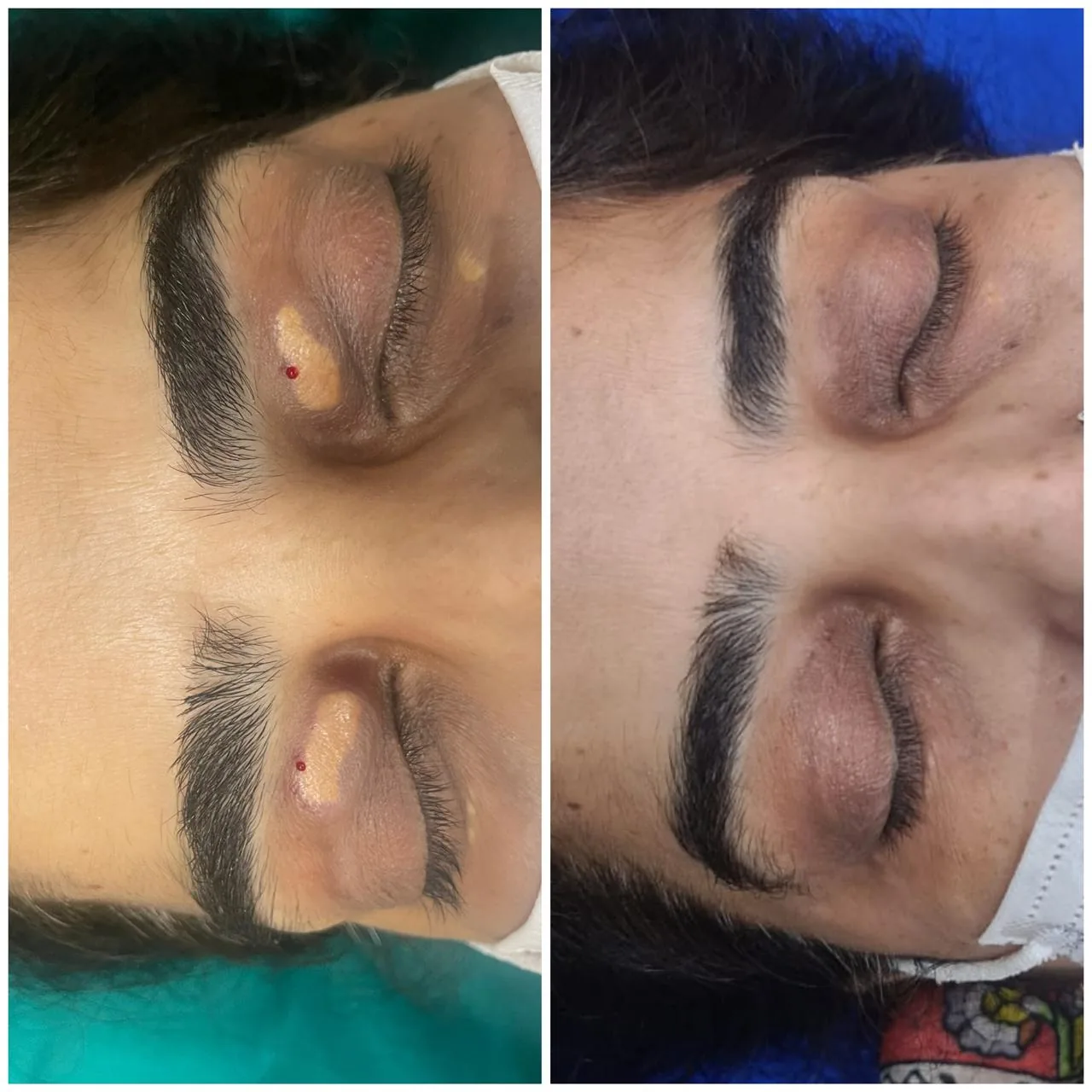 Before and after result 22