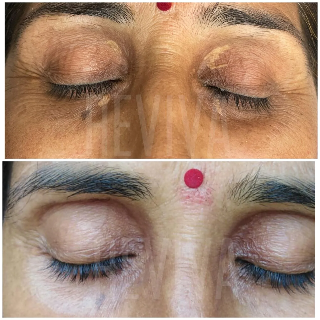 Before and after result 24